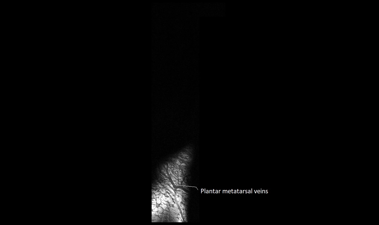 Great Toe micro anatomy MRI axial cross sectional 3T image 30.webp